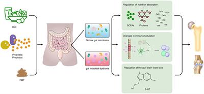 Gut Microbiota and Bone Diseases: A Growing Partnership